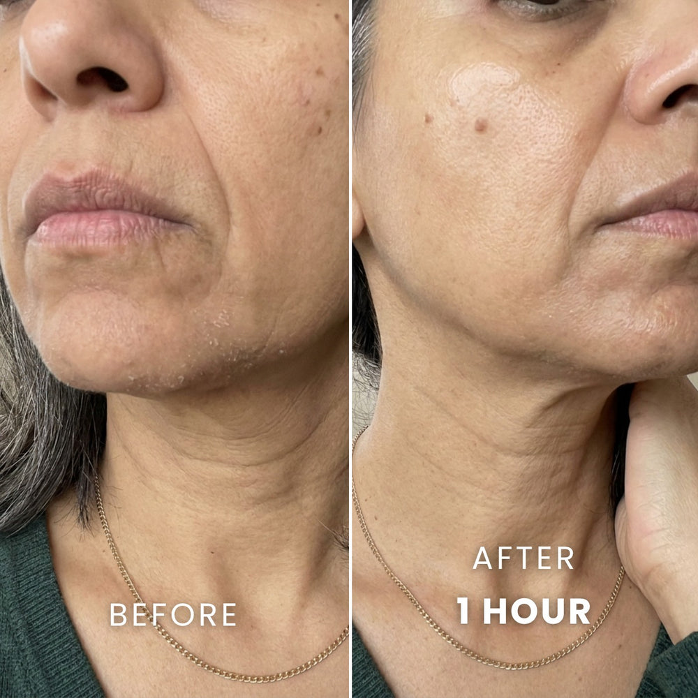Before, and one hour after the D-1 mask
